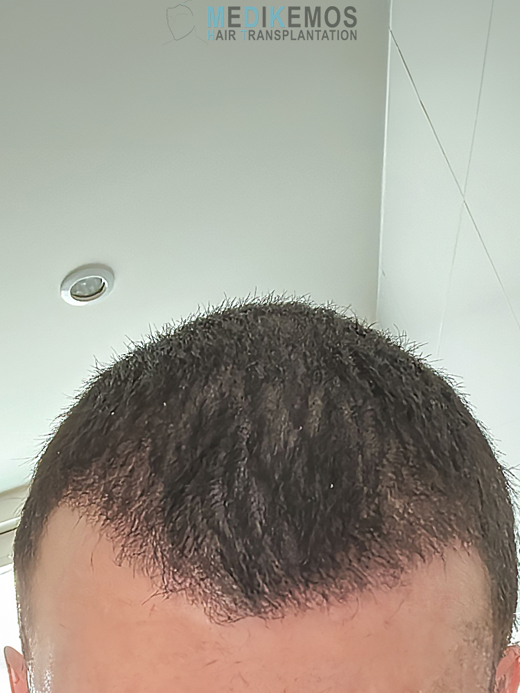 SP_1MONTH.jpg