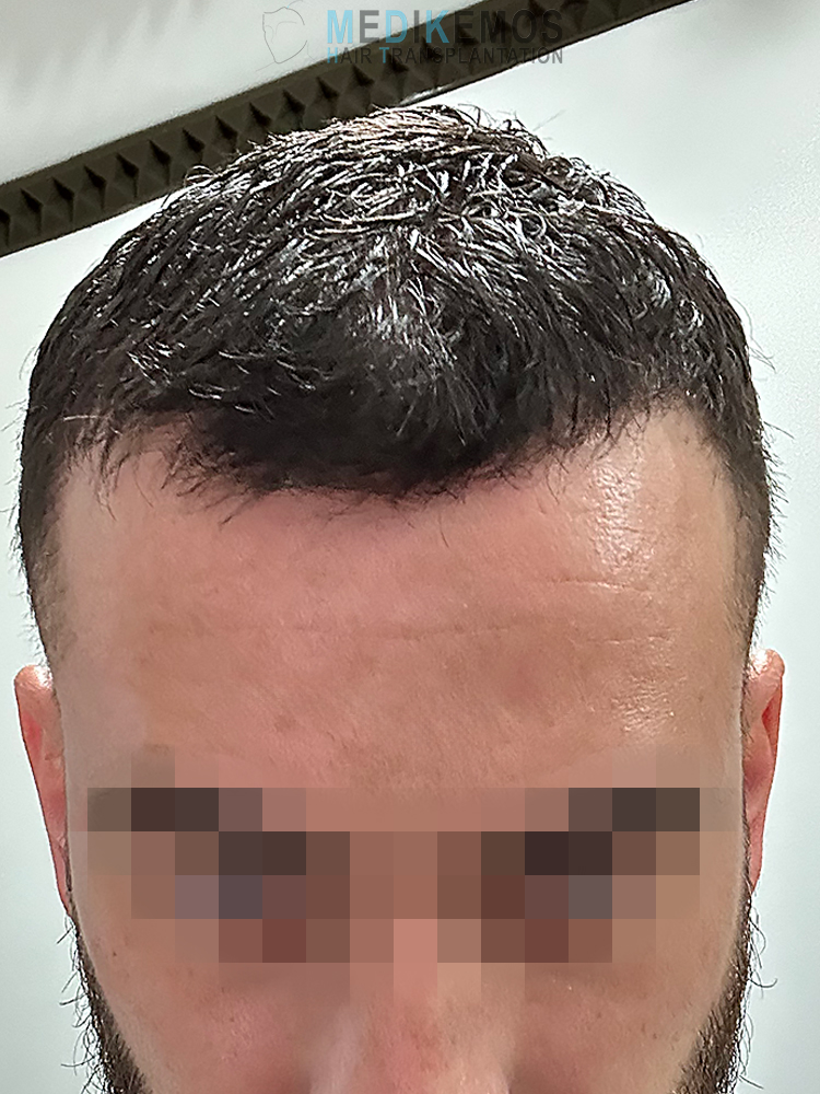 SP_6MONTHS-1.jpg