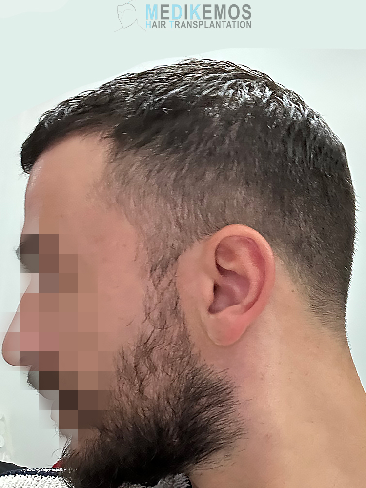 SP_6MONTHS-2.jpg