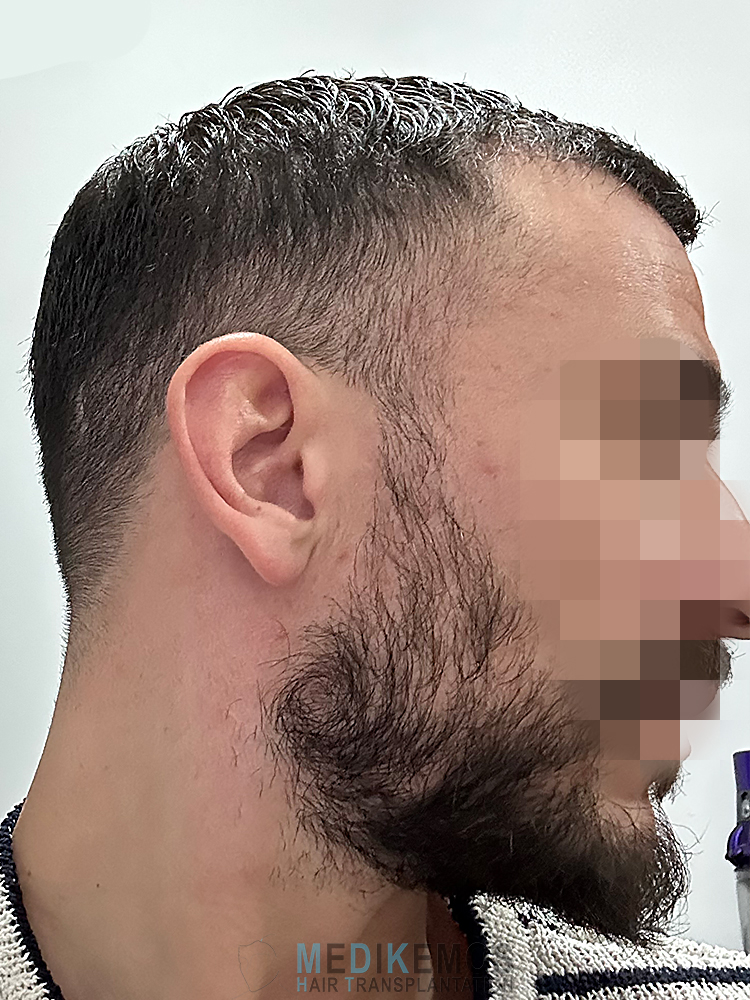 SP_6MONTHS-3.jpg