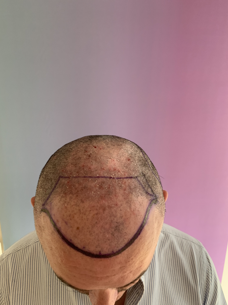 tempImagercEUUp.png