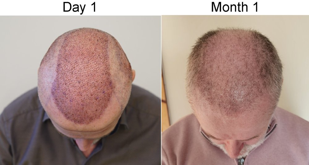 top compare.jpg