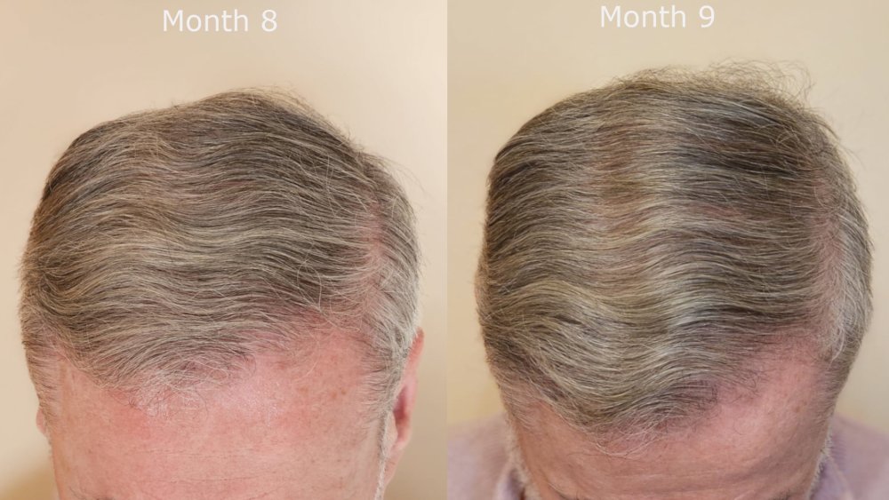 top month 8 v month 9.jpg