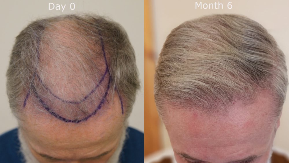 top month0 v month6.jpg