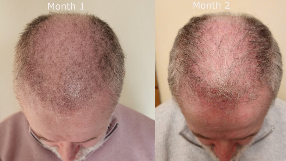 top month1 v month2.jpg