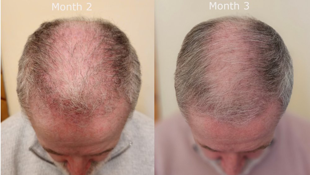 top month2 v month3.jpg