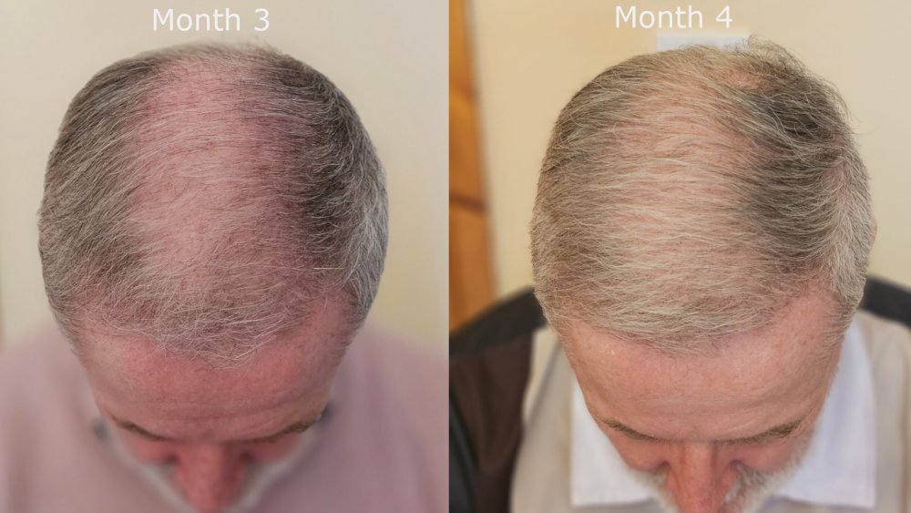 top month3 v month4.jpg