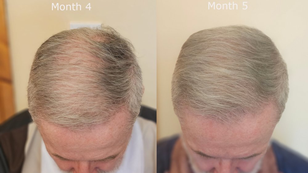 top month4 v month5.jpg