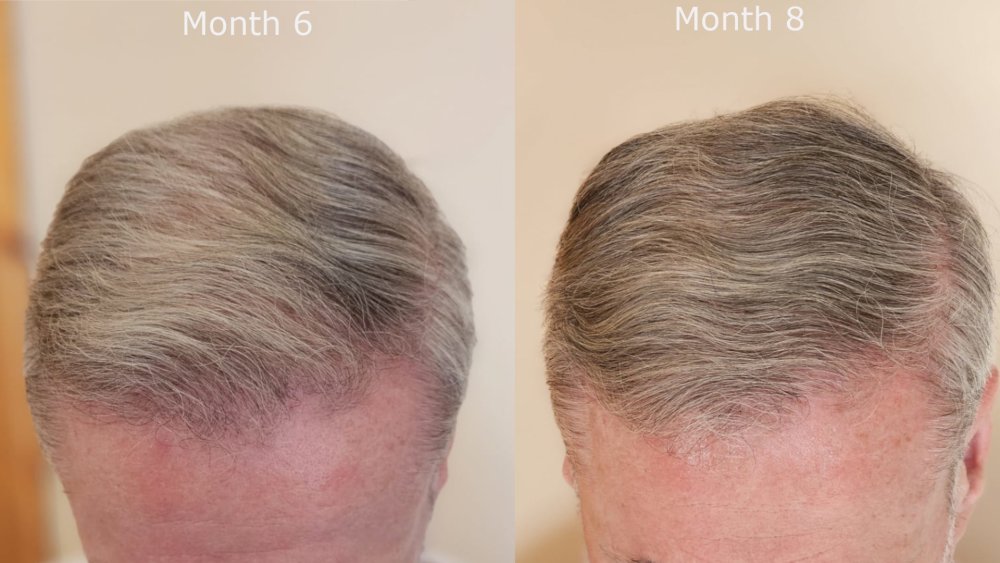 top month6 v month8.jpg