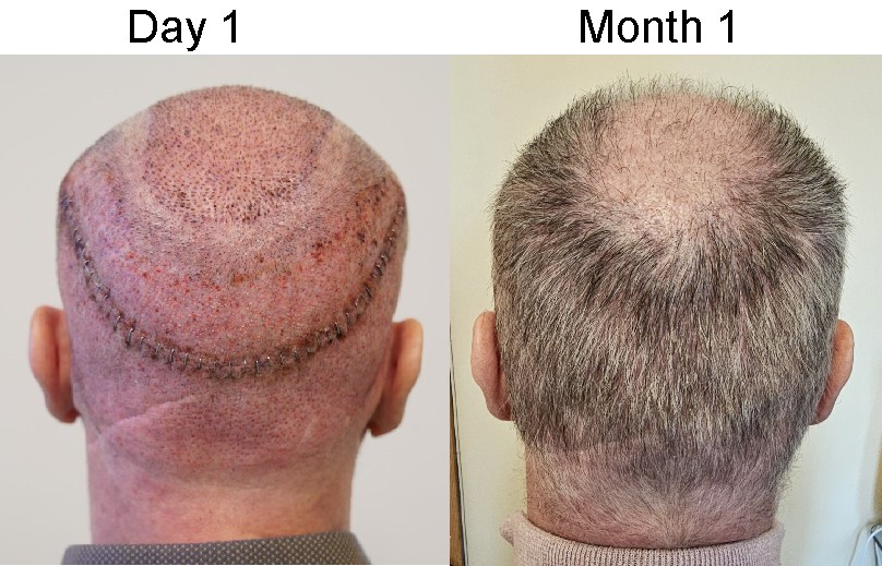 vertex month1.jpg