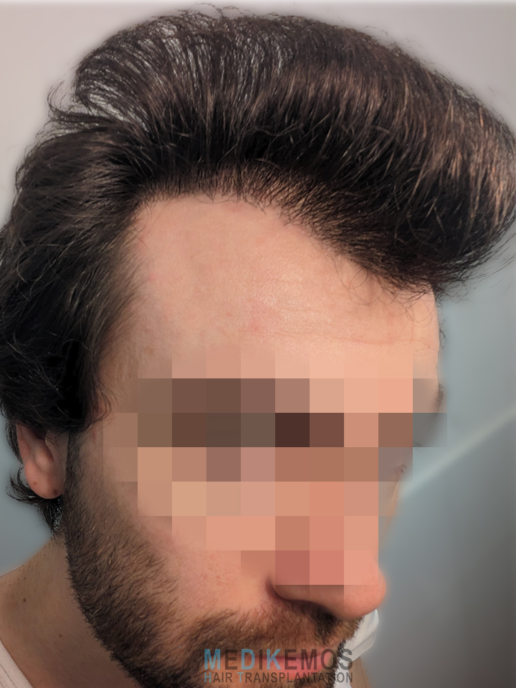 VG_6MONTHS1-.jpg