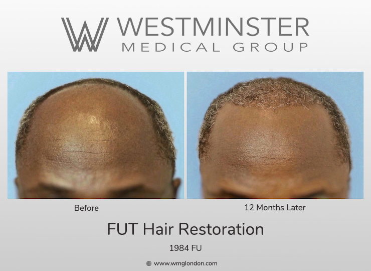 WMG Afro-Caribbean FUT.jpg