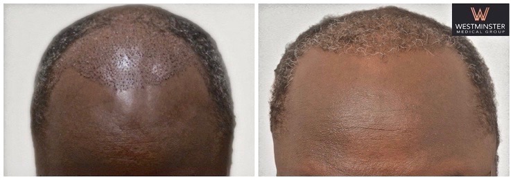 WMG Afro FUT London.jpg
