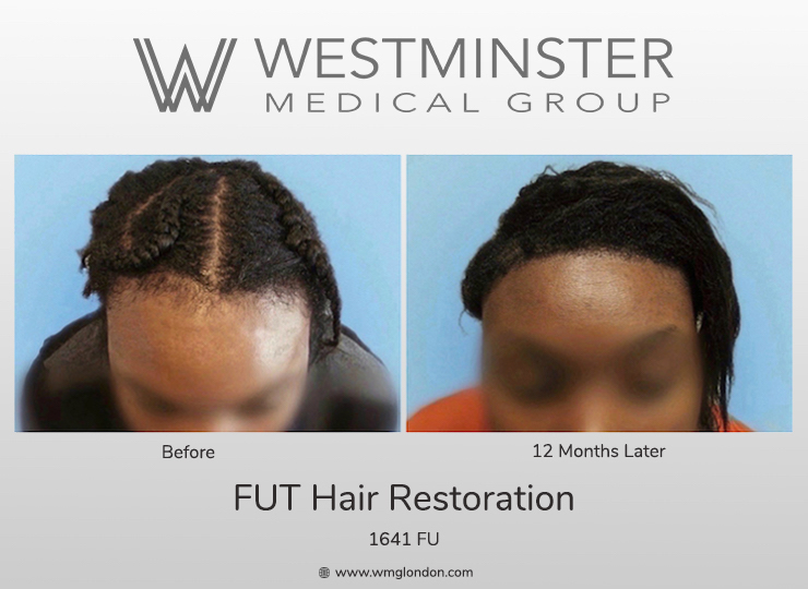 WMG FUT Traction Case.jpg