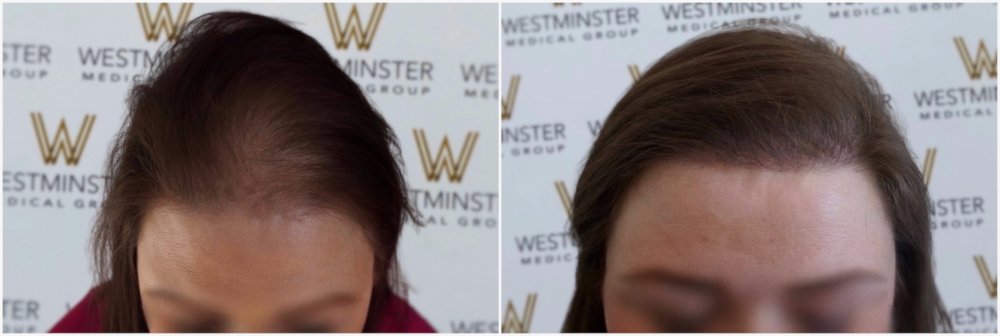 WMG London Female Diffuse FUT 998 FU.jpg