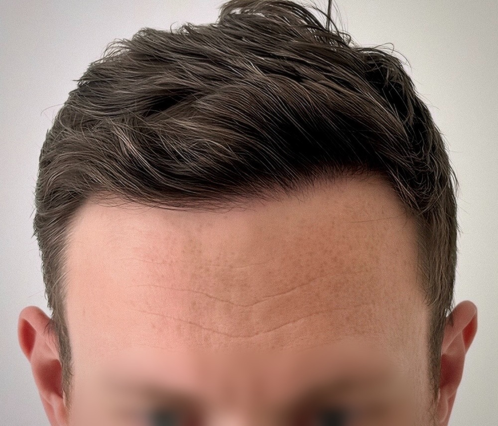 WMG London Hairline close up.jpg
