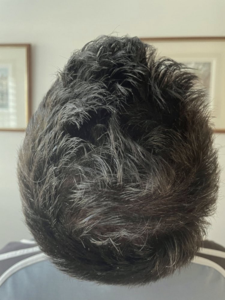 WMG Patient Crown Photo .jpg