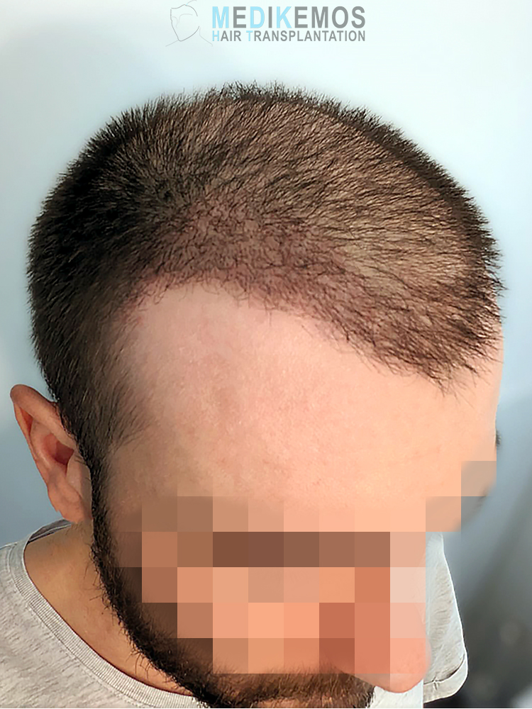 x1-PHOTOS---GV_1MONTH1.jpg