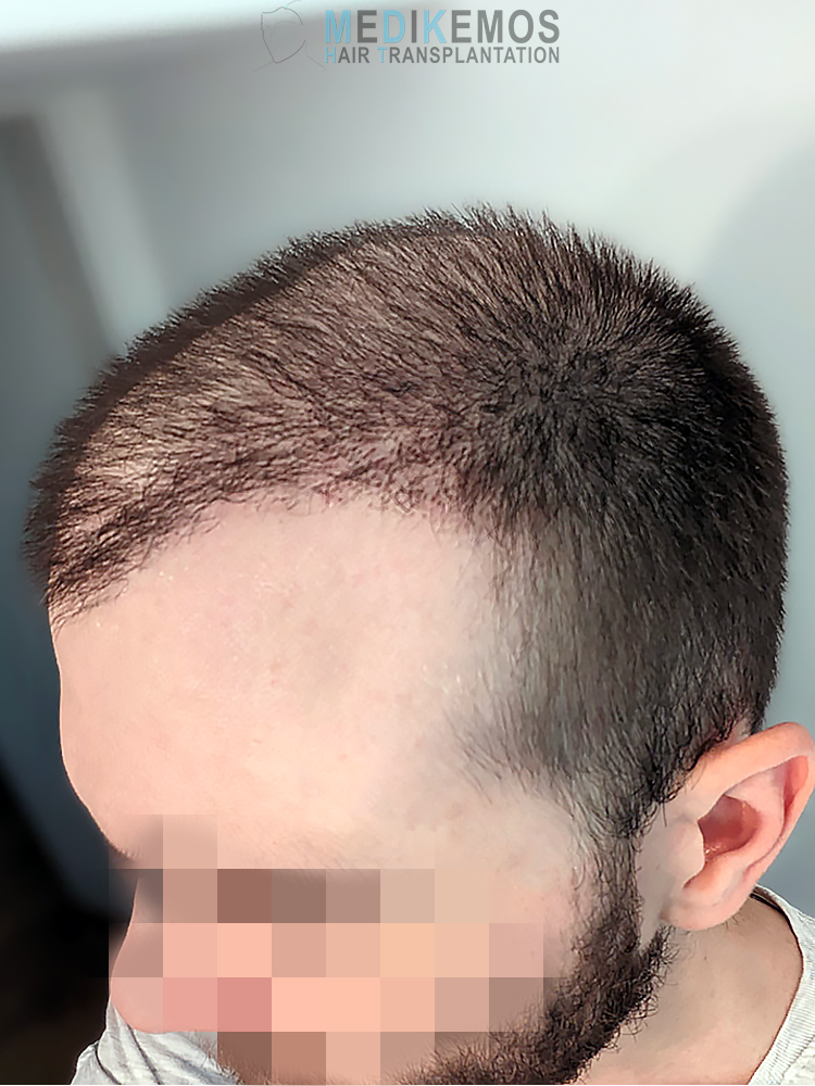 x1-PHOTOS---GV_1MONTH2.jpg