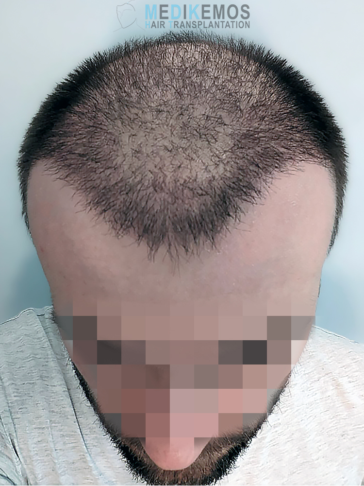 x1-PHOTOS---GV_1MONTH3.jpg