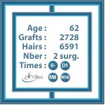 Women-Hair-Density-Resume-Presentation-Chirurgie.jpg