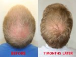 LEGRAND-Gregoire-Before-after2.jpg