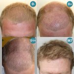 LEGRAND-Gregoire-Before-after4.jpg