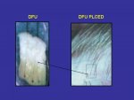 DFU photo.JPG