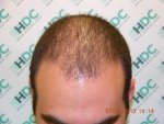 Before.JPG