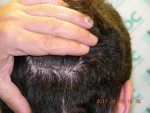 Donor at 8 months.JPG