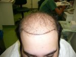 Before.JPG