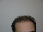 after 6 months.jpg
