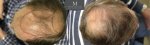 796-Before_after_Above.jpg