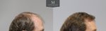 796-Before_after_right.jpg