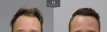 ID719-Before-after_front.jpg