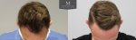 ID719-Before-after_front-top.jpg