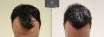Front-tilt.jpg