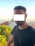 Dr Bicer FUE Hair Transplant 7.jpg