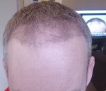 2 month recip.jpg