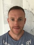 Dr Bicer Hair Transplant 3 months post op.jpg