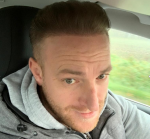Dr Bicer FUE hair transplant.png