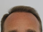 Dr Edward Maitland Ball 13.jpg