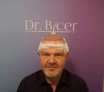 Dr Bicer Hair Tair transplant Turkey1.jpg