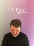 Dr Bicer Hair Tair transplant Turkey5.png
