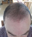 Eugenix hair sciences.jpg