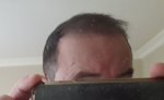 Eugenix hair sciences.jpg