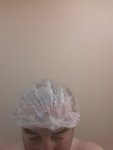 Dr Sethi Hair Transplant1.jpg