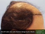 Pre-HT Pics-03.jpg