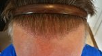 7 month scraped close up.jpg
