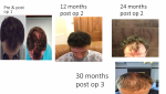Before & After.PNG